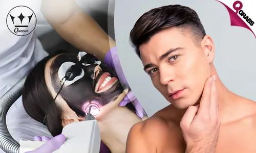 Carbon Peel & Laser Skin Lightening/Toning for Ladies & Men!